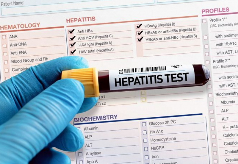Монгол улс вируст гепатит өвчний эмчилгээнд хэрэглэдэг оросын эмүүдийг татвараас чөлөөлнө